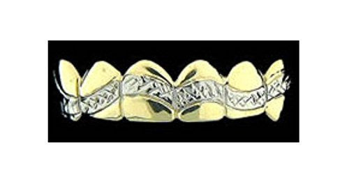 Customized 14k Gold Overlay Removable Gold Teeth / Caps / Grillz 6 Teeth /h14/ Jewelry Woxpa Woxpa - Jewelry - Woxpa - Jewelry