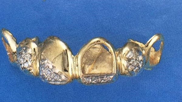 Customized 14k Gold Overlay Removable Gold With 20cz Stone 6 Teeth /h20/ Jewelry Woxpa Woxpa - Jewelry - Woxpa - Jewelry