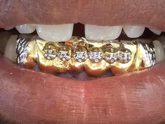 Customized 14k Gold Overlay Removable Gold With 6cz Stone 6 Teeth /h22/ Jewelry Woxpa Woxpa - Jewelry - Woxpa - Jewelry
