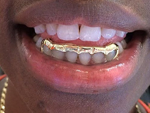 Customized 14k Gold Overlay Removable Gold Teeth / Caps / Grillz 6 Teeth /h8/  Jewelry Woxpa  Woxpa - Jewelry - Woxpa - Jewelry