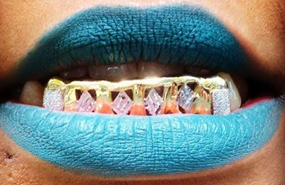 Custom Made 14k Gold Overlay Removable Grillz Teeth /Gold Plate Caps/ 6 Teeth Top or Bottom Fangs/8