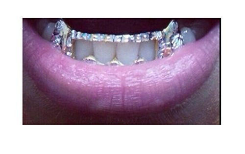 Customized 14k Gold Overlay Removable Gold Teeth / Caps / Grillz 6 Teeth /h15/  Jewelry Woxpa  Woxpa - Jewelry - Woxpa - Jewelry