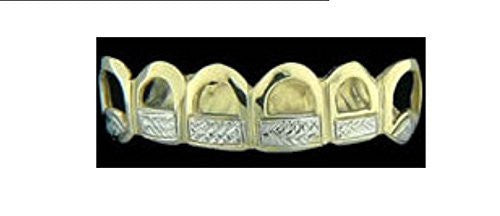 Customized 14k Gold Overlay Removable Gold Teeth / Caps / Grillz 6 Teeth /h17/  Jewelry Woxpa  Woxpa - Jewelry - Woxpa - Jewelry