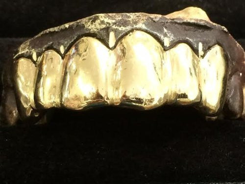 Customized 10k Gold Removable Gold Teeth / Caps / Grillz 6 Teeth /h35/  Jewelry Woxpa  Woxpa - Jewelry - Woxpa - Jewelry
