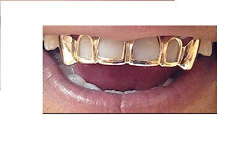 Customized 14k Gold Overlay Removable Gold Teeth / Caps / Grillz 6 Teeth /h7/  Jewelry Woxpa  Woxpa - Jewelry - Woxpa - Jewelry
