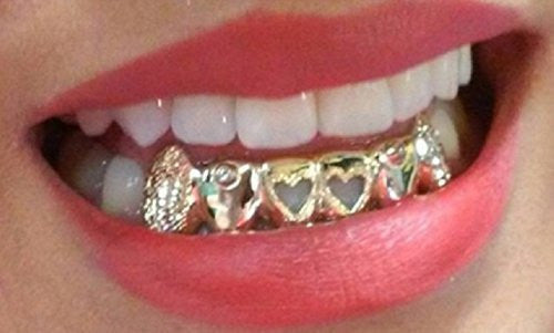 Customized 14k Gold Overlay Removable Gold Teeth / Caps / Grillz 6 Teeth /h9/  Jewelry Woxpa  Woxpa - Jewelry - Woxpa - Jewelry